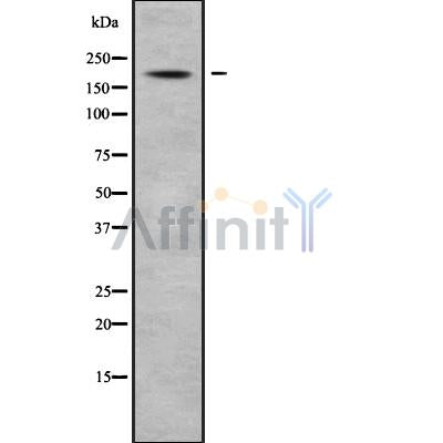 Western blot analysis of extracts from hepg2, using ABCC8 Antibody. Lane 1 was treated with the blocking peptide.