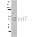 Western blot analysis of DDX18 using HuvEc whole cell lysates