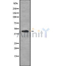 Western blot analysis of extracts from HepG2, using KCNJ10 Antibody. Lane 1 was treated with the blocking peptide.