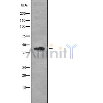 Western blot analysis of extracts from HepG2, using KCNJ10 Antibody. Lane 1 was treated with the blocking peptide.