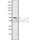 Western blot analysis of extracts from various samples, using KCNJ14 Antibody.
 Lane 1: Myeloma cells treated with blocking peptide;
 Lane 2: Myeloma cells;
 Lane 3: COS-7;
 Lane 4: Rat  spleen.