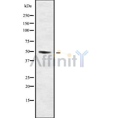 Western blot analysis of extracts from various samples, using KCNJ14 Antibody.
 Lane 1: Myeloma cells treated with blocking peptide;
 Lane 2: Myeloma cells;
 Lane 3: COS-7;
 Lane 4: Rat  spleen.