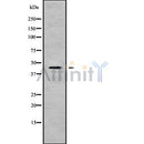 Western blot analysis of KCNJ15 using HeLa whole cell lysates