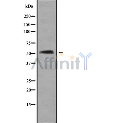 Western blot analysis of extracts from various samples, using BAGE5 Antibody.
 Lane 1: VERO treated with blocking peptide;
 Lane 2: VERO;
 Lane 3: HepG2.