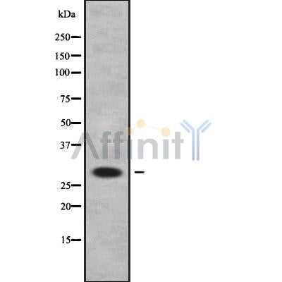 Western blot analysis of BATF2 using HeLa whole cell lysates