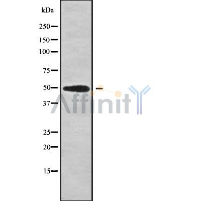 Western blot analysis of extracts from VERO, using B3GALT2 Antibody. The lane on the left was treated with blocking peptide.