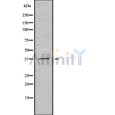 Western blot analysis of B3GALT6 using HuvEc whole cell lysates
