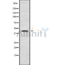 Western blot analysis of B4GALT2 using Jurkat whole cell lysates