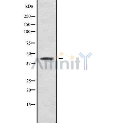 Western blot analysis of B4GALT2 using Jurkat whole cell lysates