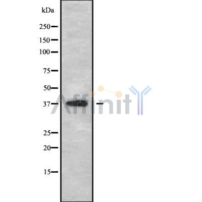 Western blot analysis of extracts from COS-7, using B4GALT7 Antibody. The lane on the left was treated with blocking peptide.