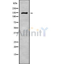 DF9278 at 1/100 staining Human lymph node tissue by IHC-P. The sample was formaldehyde fixed and a heat mediated antigen retrieval step in citrate buffer was performed. The sample was then blocked and incubated with the antibody for 1.5 hours at 22¡ãC. An HRP conjugated goat anti-rabbit antibody was used as the secondary