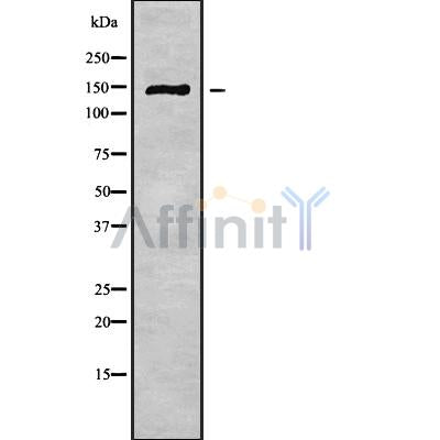 DF9278 at 1/100 staining Human lymph node tissue by IHC-P. The sample was formaldehyde fixed and a heat mediated antigen retrieval step in citrate buffer was performed. The sample was then blocked and incubated with the antibody for 1.5 hours at 22¡ãC. An HRP conjugated goat anti-rabbit antibody was used as the secondary