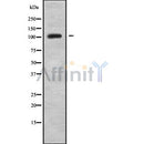 Western blot analysis of extracts from C6, using BMP1 Antibody. The lane on the left was treated with blocking peptide.

Observed bands: 95 kDa.