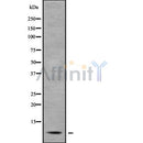 Western blot analysis of extracts from various samples, using PEP-19 Antibody.
 Lane 1: Hela treated with blocking peptide;
 Lane 2: Hela;
 Lane 3: VERO;
 Lane 4: HepG2.