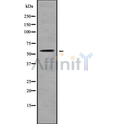 Western blot analysis SLC22A17 using K562 whole cell lysates
