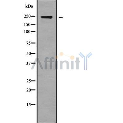 Western blot analysis of extracts from Huvec, using CABIN1 Antibody. The lane on the left was treated with blocking peptide.