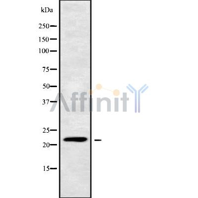 DF9295 at 1/100 staining Human spleen tissue by IHC-P. The sample was formaldehyde fixed and a heat mediated antigen retrieval step in citrate buffer was performed. The sample was then blocked and incubated with the antibody for 1.5 hours at 22¡ãC. An HRP conjugated goat anti-rabbit antibody was used as the secondary