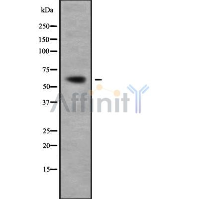 DF9298 at 1/100 staining Human lung tissue by IHC-P. The sample was formaldehyde fixed and a heat mediated antigen retrieval step in citrate buffer was performed. The sample was then blocked and incubated with the antibody for 1.5 hours at 22¡ãC. An HRP conjugated goat anti-rabbit antibody was used as the secondary