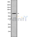 DF9303 at 1/200 staining human lymphoma tissue sections by IHC-P. The tissue was formaldehyde fixed and a heat mediated antigen retrieval step in citrate buffer was performed. The tissue was then blocked and incubated with the antibody for 1.5 hours at 22¡ãC. An HRP conjugated goat anti-rabbit antibody was used as the secondary