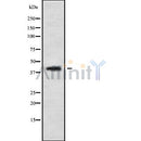 Western blot analysis of CABP1 using HepG2 whole cell lysates