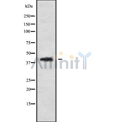 Western blot analysis of CABP1 using HepG2 whole cell lysates