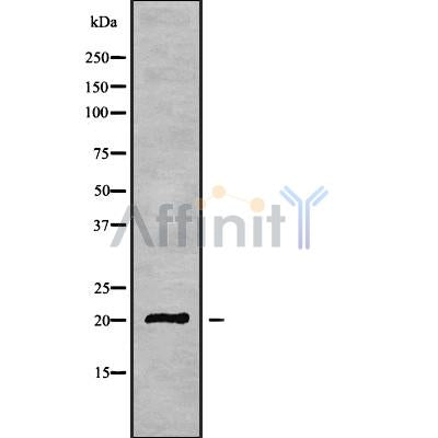 Western blot analysis of CABP3 using HeLa whole cell lysates