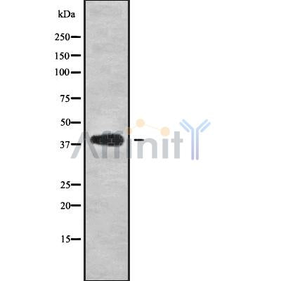 Western blot analysis of CAB39L using COS7 whole cell lysates