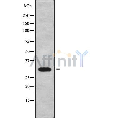 Western blot analysis of CABP4 using Jurkat whole cell lysates