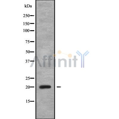 Western blot analysis of CABP5 using Jurkat whole cell lysates