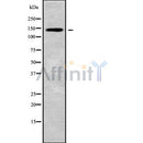 Western blot analysis of extracts from rat brain, using CADPS2 Antibody.