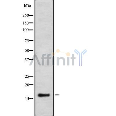 DF9315 at 1/100 staining Human Melanoma tissue by IHC-P. The sample was formaldehyde fixed and a heat mediated antigen retrieval step in citrate buffer was performed. The sample was then blocked and incubated with the antibody for 1.5 hours at 22¡ãC. An HRP conjugated goat anti-rabbit antibody was used as the secondary