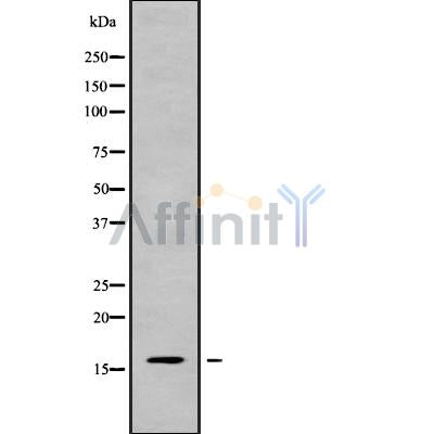 DF9316 at 1/100 staining Human lung cancer tissue by IHC-P. The sample was formaldehyde fixed and a heat mediated antigen retrieval step in citrate buffer was performed. The sample was then blocked and incubated with the antibody for 1.5 hours at 22¡ãC. An HRP conjugated goat anti-rabbit antibody was used as the secondary