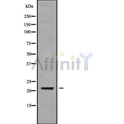 DF9317 at 1/100 staining Mouse muscle tissue by IHC-P. The sample was formaldehyde fixed and a heat mediated antigen retrieval step in citrate buffer was performed. The sample was then blocked and incubated with the antibody for 1.5 hours at 22¡ãC. An HRP conjugated goat anti-rabbit antibody was used as the secondary