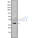 Western blot analysis of CAPNS2 using 293 whole cell lysates
