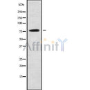 Western blot analysis of CAPN13 using Jurkat whole cell lysates