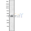 Western blot analysis of CNN3 using RAW264.7 whole cell lysates