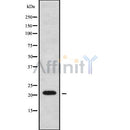 Western blot analysis of extracts from rat spleen, using CTAG2 Antibody.