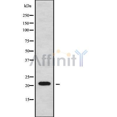 Western blot analysis of extracts from rat spleen, using CTAG2 Antibody.