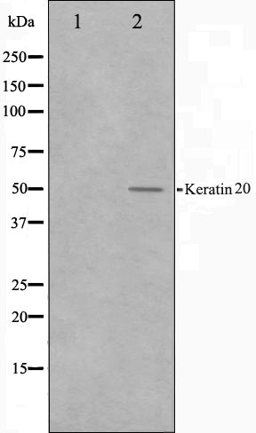 Western blot analysis on HeLa cell lysate using Keratin 20 Antibody. The lane on the left is treated with the antigen-specific peptide.