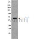 Western blot analysis of extracts from rat spleen, using CHST11 Antibody.