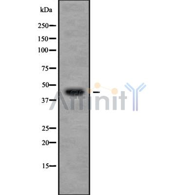 Western blot analysis of extracts from rat spleen, using CHST11 Antibody.