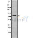 Western blot analysis of CHST3 using Jurkat whole cell lysates