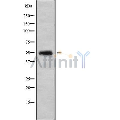 Western blot analysis of CHST5 using COLO205 whole cell lysates