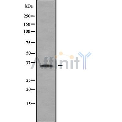 Western blot analysis of CA8 using K562 whole cell lysates