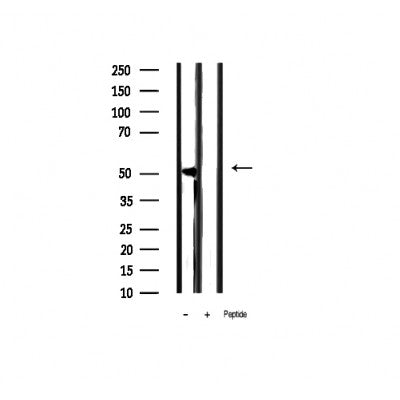 AF3097 staining 293 by IF/ICC. The sample were fixed with PFA and permeabilized in 0.1% Triton X-100,then blocked in 10% serum for 45 minutes at 25¡ãC. The primary antibody was diluted at 1/200 and incubated with the sample for 1 hour at 37¡ãC. An  Alexa Fluor 594 conjugated goat anti-rabbit IgG (H+L) Ab, diluted at 1/600, was used as the secondary antibod