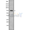 DF9341 staining A549 by IF/ICC. The sample were fixed with PFA and permeabilized in 0.1% Triton X-100,then blocked in 10% serum for 45 minutes at 25¡ãC. The primary antibody was diluted at 1/200 and incubated with the sample for 1 hour at 37¡ãC. An  Alexa Fluor 594 conjugated goat anti-rabbit IgG (H+L) Ab, diluted at 1/600, was used as the secondary antibod