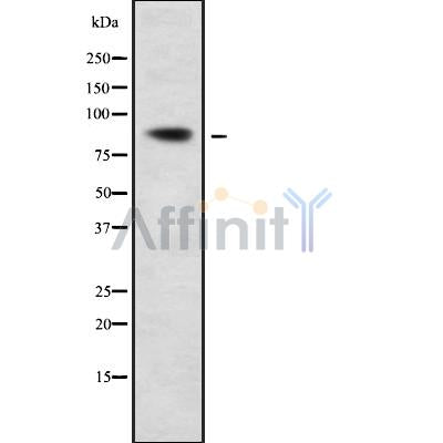 DF9342 at 1/100 staining Mouse kidney tissue by IHC-P. The sample was formaldehyde fixed and a heat mediated antigen retrieval step in citrate buffer was performed. The sample was then blocked and incubated with the antibody for 1.5 hours at 22¡ãC. An HRP conjugated goat anti-rabbit antibody was used as the secondary