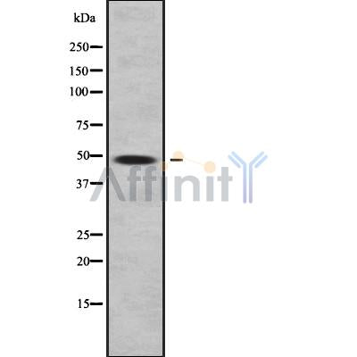 DF9343 at 1/100 staining Mouse kidney tissue by IHC-P. The sample was formaldehyde fixed and a heat mediated antigen retrieval step in citrate buffer was performed. The sample was then blocked and incubated with the antibody for 1.5 hours at 22¡ãC. An HRP conjugated goat anti-rabbit antibody was used as the secondary