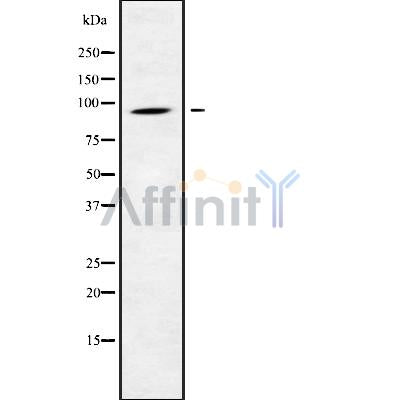Western blot analysis of CATSPER1 using K562 whole cell lysates