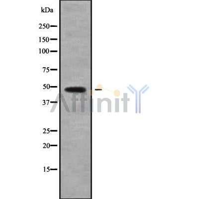 Western blot analysis of CATSPER3 using Jurkat whole cell lysates
